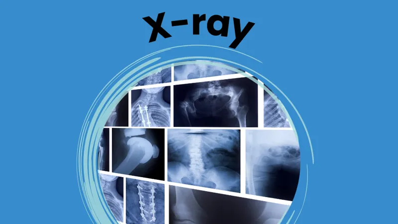 What to Expect from Scans and Tests: X-ray